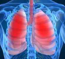 Kako tretirati upale pluća? korisne savete