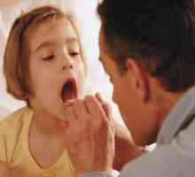 Kako tretirati laringitisa kod djeteta? Izbor pouzdan metod