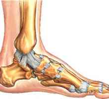 Kako tretirati istegnuće ligamenata u nogu. tretman iščašenje i dalje oporavak