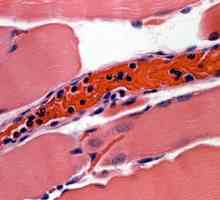 Kako smanjiti bijelih krvnih stanica u krvi? Uzroci povišenih leukocita. Doktor je savjet da se…