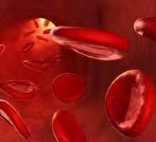 Kako povećati hemoglobina u kući: najefikasnije metode