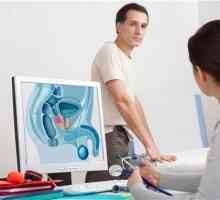 Koji su simptomi prostatitis? Kućno liječenje efektivne tradicionalne metode