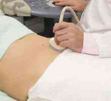 Kako je ginekološki ultrazvuk kod žena
