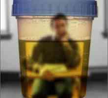 Kako proći test urina ispravno?