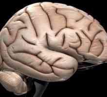 Kako poboljšati cirkulaciju mozga. Lijekovi koji poboljšavaju cirkulaciju mozga