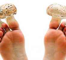 Ono što liječnik tretira noktiju gljiva na noge - mikolog ili dermatologa?