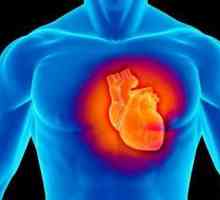 Kardiomiopatija - ovo ... dishormonal i dysmetabolic kardiomiopatija