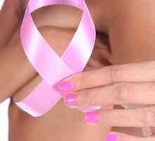 Kada mamograma i kako se pripremiti za to?