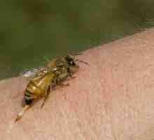 Konsultacije sa specijalistom: Što učiniti ako ujede pčela