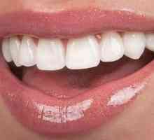 Plastične krunice na prednjim zubima: indikacije, recenzije, fotografije
