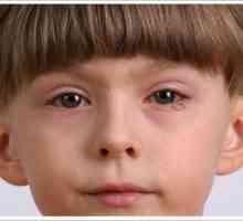 Crvene oči beba: uzroci, liječenje i prevenciju