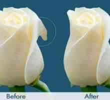 Labioplastika: prije i poslije. Komentar Cijene