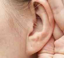 Laser otoplastici: komentari i rezultata. Uši nakon Otoplastika - preporuke. Otoplastika (Operacija…