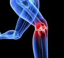Terapijske vježbe kod osteoartritisa koljena: vježbe, pravila za njihovu realizaciju