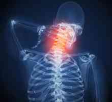 Terapijske vježbe u osteohondroze vratne kralježnice: fotografiju, vježbe