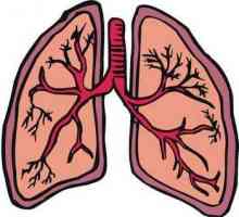Tretman bronhitisa i simptome