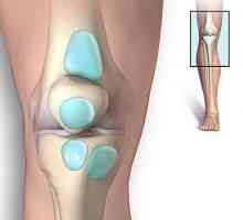 Tretman burzitis koljena: povratak lako hod