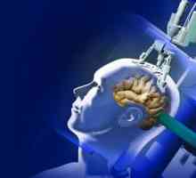 Tretman tumora mozga u Izraelu - inovativne metode