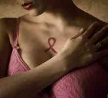 Liječenju karcinoma dojke u Izraelu, glavne karakteristike