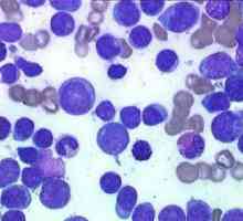Leukocitoza - šta je ovo bolest?