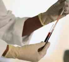 Bijelih krvnih stanica se povećala u djeteta krv: Uzroci