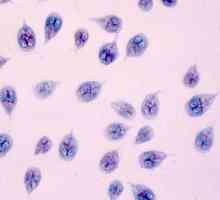 Giardia u djeteta: kako infekcija, simptomi, liječenje