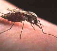 Malariju. Simptomi zaraze