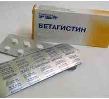Medicament "betahistine". indikacije