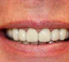 Metal-keramičke zube. Protetika: cermet