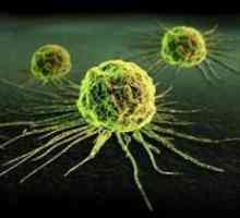 Metode za detekciju ćelije raka u ljudskom tijelu