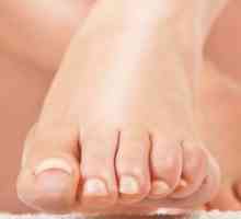 Gljivične infekcije noktiju na nogama: droga tretman i narodne lekove