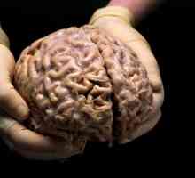 Ljudski mozak: struktura