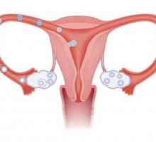 Mogu li dobiti trudna sa jednom cijevi? ginekolog odgovor