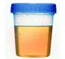 Oblačno urin u djece: mogući uzroci