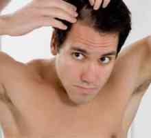 Folk pravna sredstva za gubitak kose: Komentari muškaraca i žena
