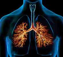 Ne propustite simptome hroničnog bronhitisa!