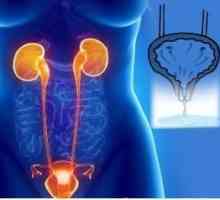 Urinarne inkontinencije u starijih žena: tretman i uzroci
