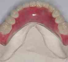 Najlon proteza u nedostatku zuba i parcijalne. Komentari o najlon proteza