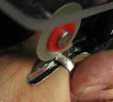 Nekoliko savjeta o tome kako da uklonite prsten od otečena prsta-pati