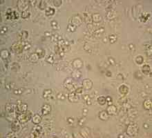 Norma leukociti u urinu kod djece. Bijelih krvnih stanica u mokraći djeteta: normalno, razlozi za…
