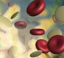 Šta povišen broj bijelih krvnih stanica u djece