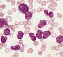 Šta povećala neutrofila u krvi?