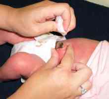 Tretman novorođenče pupčane rane: ono što je potrebno i kakva je procedura