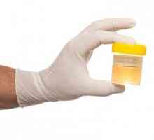 General savjete o tome kako da se test urina