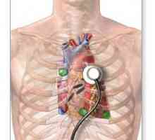 Pregled srca. Ultrazvuk srca: to pokazuje? Metode Heart Survey