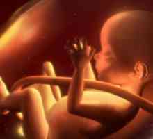 Cord uplitanje: uzroke i posljedice. Zašto fetus od zapetljavanja pupčanu vrpcu?