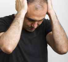 Alopecija areata kod muškaraca: tretman narodnih pravnih sredstava i lijekova, fotografije,…