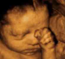 Određivanje pol bebu na ultrazvuk, kao precizno