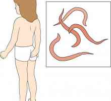 Pinworms u dijete: metode liječenja i prevencije bolesti