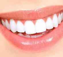 Pobelite zubi bez oštećenja cakline